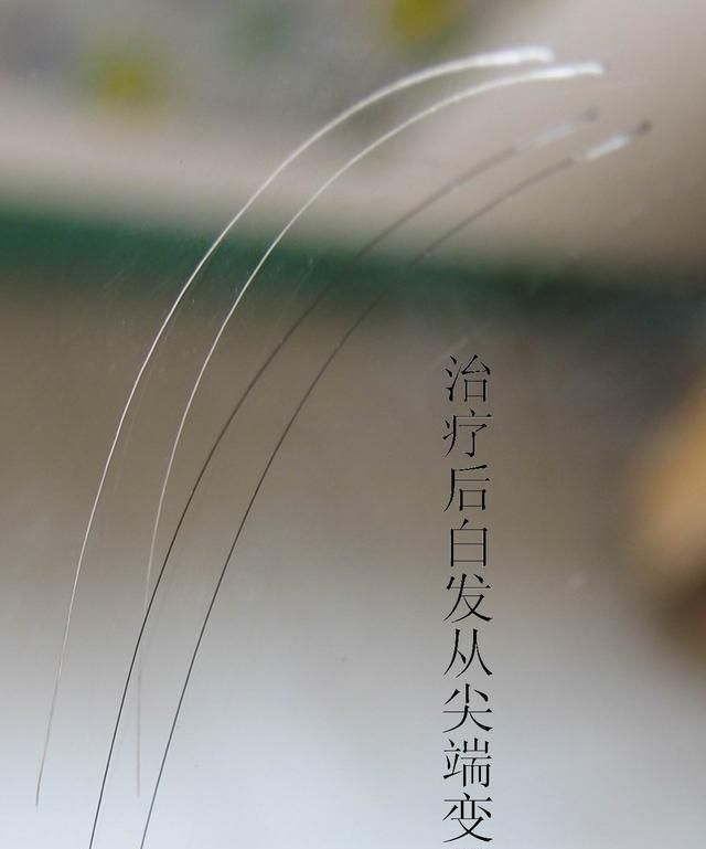 5个小妙招巧治口腔溃疡，反反复复口腔溃疡怎么办？图6