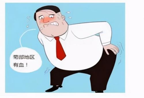 脱肛怎么办能自愈吗(老是脱肛怎么办)-第2张图片-