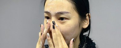 ​黑头挤完鼻子上有洞眼咋回事