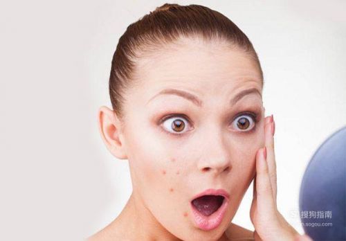 怎么去痘印快有效的方法(怎么去痘印快的方法)-第1张图片-