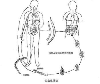 钩虫病的症状有哪些？胃部钩虫病的症状-第1张图片-