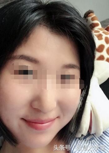 抬头纹好不好面相(女人额头有抬头纹好不好)-第2张图片-