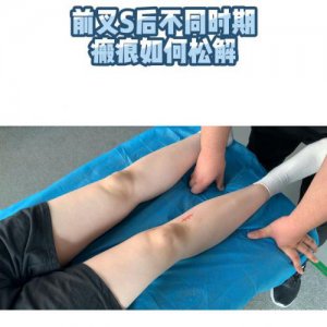 ​s弯道技巧图解怎么找中心点(s弯道看点技巧图解)