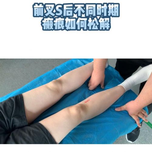 s弯道技巧图解怎么找中心点(s弯道看点技巧图解)-第1张图片-