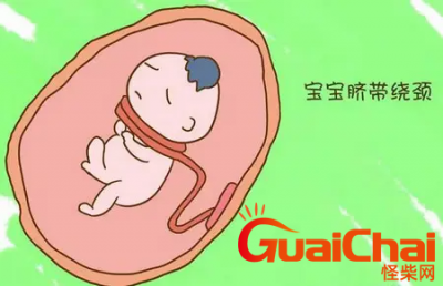 ​脐带绕颈和睡姿有关吗？脐带绕颈是因为什么原因造成的