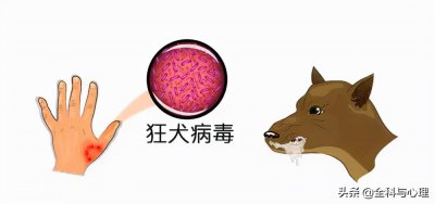 ​狂犬疫苗最佳时间是多少小时内 被狗咬了一定要24小时内打狂犬病疫苗吗？