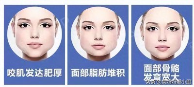 ​咬肌变大对于我们面部的容貌影响很大