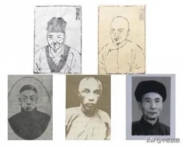 ​熟地的副作用 温补派张景岳，擅长运用熟地黄，有“张熟地”之称