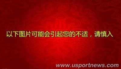 ​保罗乔治受伤 盘点篮球界断腿事件骨头外翻惨不忍睹