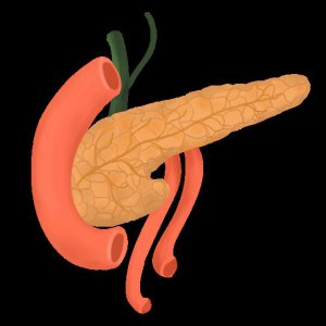 ​胰腺炎是哪个部位疼（被称为“生不如死”的胰腺炎是一种怎样的疾病？）