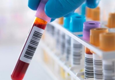 ​甘油三酯高吃什么好得最快（甘油三酯高了，怎么吃才能快速降下来？只知道不吃