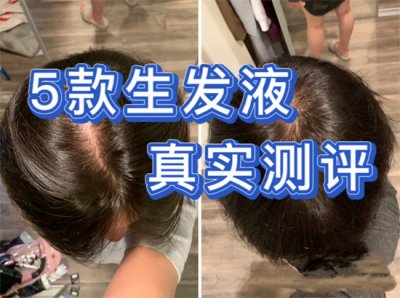 ​霸王生发（5款热门生发液真实测评来了）