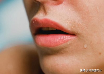 ​嘴唇起皮是什么原因怎么治疗（你的嘴唇是否有脱皮、瘙痒等症状，今天教你如何