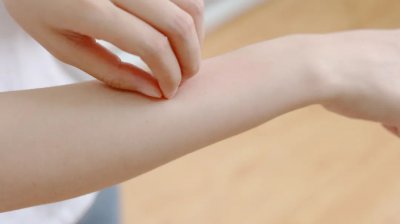 ​什么是接触性皮炎发病特点是什么（接触性皮炎是什么？原因有2种，程度不同，