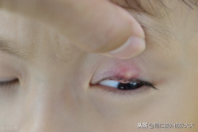 ​眼科常见的手术有哪些类（眼科疾病怎么治？常见眼科手术有哪几大类？）