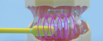 ​到底怎么刷牙才正确 怎么样刷牙才是正确的