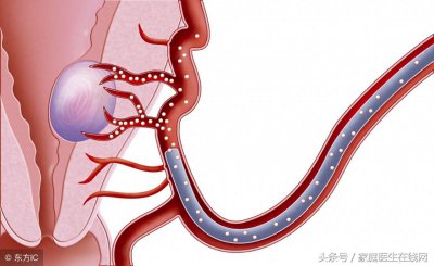 ​女人长了子宫肌瘤，身体会有这4个“异常”，尽早去查下