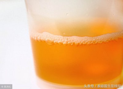 ​尿液发黄就是代表肾虚？如果是这3个原因，完全不必担心