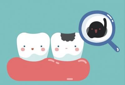 ​如果你的蛀牙到这种程度了，就不能靠补牙拯救了