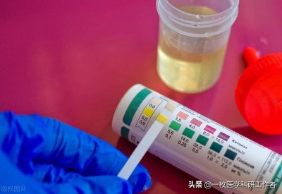 ​人的正常尿液是什么颜色 正常尿液颜色呈什么色