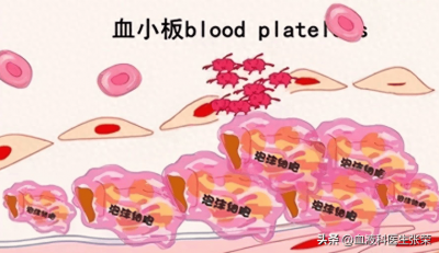 ​化验结果血小板低会是什么病 血液检测血小板低