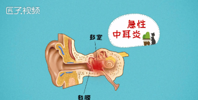 ​咽喉痛会导致耳朵痛吗怎么治疗 咽喉痛会引起耳朵痛吗
