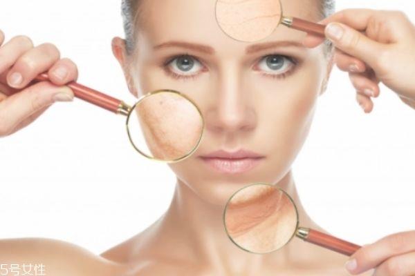 底妆暗沉怎么办 控制油脂的分泌 底妆暗沉怎么办 控制油脂的分泌