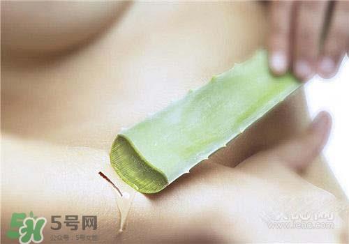 芦荟涂在脸上发痒是怎么回事?芦荟涂在脸上发痒怎么办? 芦荟涂在脸上发痒是怎么回事?芦荟涂在脸上发痒怎么办?