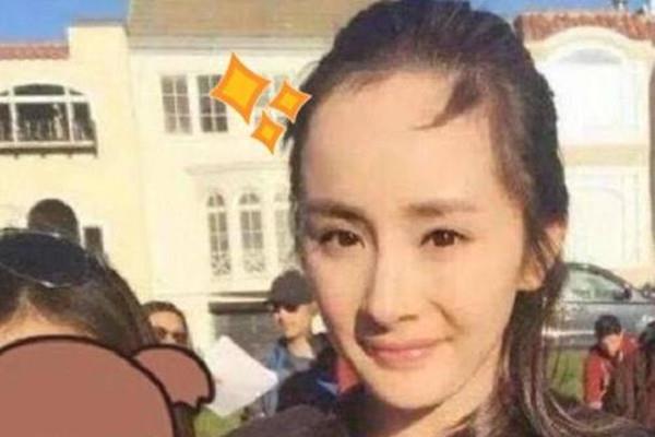 发际线可以自行恢复吗 发际线后移的原因