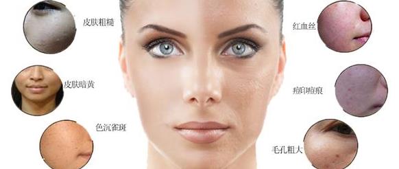 光子嫩肤多少钱 这个价格并不贵