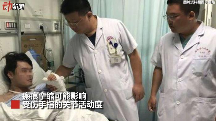 男生手指被炸骨折，都是一瓶冰可乐惹的祸！