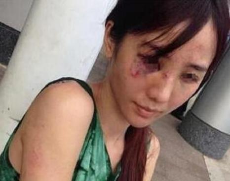 怀孕期间被丈夫暴打，与病魔斗争坚持拍戏，27岁死于子宫癌