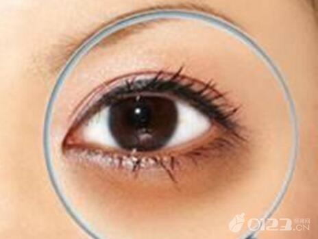 黄子韬幼儿园合影: 天生黑眼圈, 小平头萌萌哒! 黑眼圈怎么破?