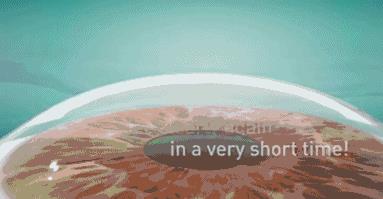 十年前悄咪咪做了近视激光手术的明星们,现在还好吗?