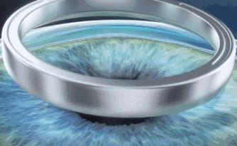 十年前悄咪咪做了近视激光手术的明星们,现在还好吗?