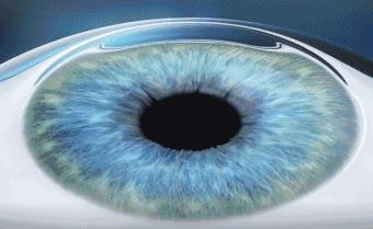 十年前悄咪咪做了近视激光手术的明星们,现在还好吗?