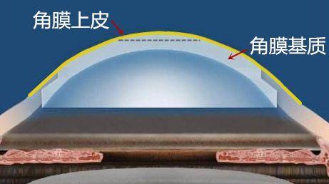 十年前悄咪咪做了近视激光手术的明星们,现在还好吗?