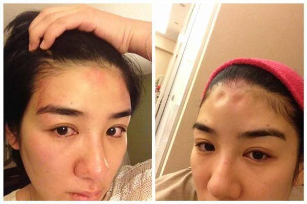 仿妆网红宇芽被家暴引发热议!盘点近年来惨遭家暴的八大女星