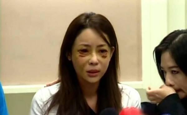 仿妆网红宇芽被家暴引发热议!盘点近年来惨遭家暴的八大女星