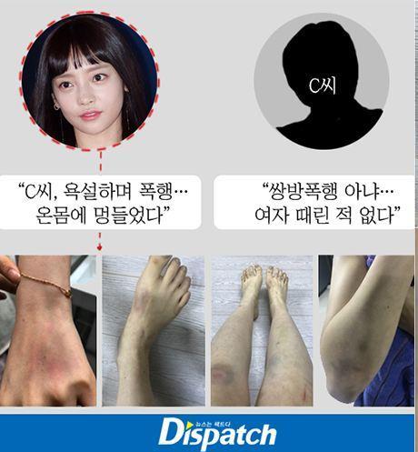 仿妆网红宇芽被家暴引发热议!盘点近年来惨遭家暴的八大女星