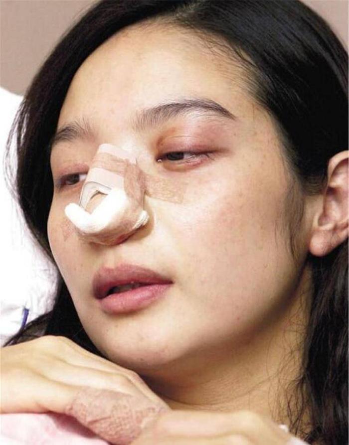 仿妆网红宇芽被家暴引发热议!盘点近年来惨遭家暴的八大女星