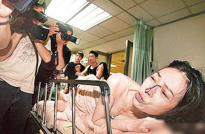 仿妆网红宇芽被家暴引发热议!盘点近年来惨遭家暴的八大女星