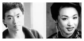 变性人寿命低于50岁，金星为保命拒服药，今容颜大变越来越男相