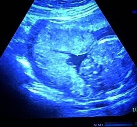 邹凯当爸晒妻子B超照，邹凯妻子周捷背景资料