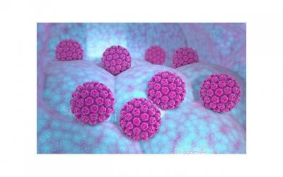 ​女的用嘴巴吃弟会得HPV 一个男人有两个女人HPV感染