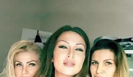 这个国外蛇精女,认为自己上辈子是蛇,不惜花重金多次整容