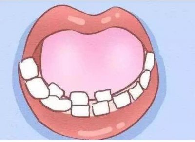 ​儿童长出双排牙，看完你说拔不拔