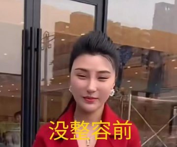 ​二驴妻子整容前照片曝光，前后判若两人，二驴自曝共花了1000多万