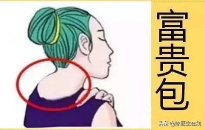 ​脖子后的“富贵包”究竟是什么？
