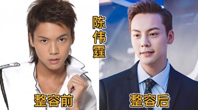 ​18位男星整容对比，陈浩民填充成发面馍馍，陈伟霆好似脱胎换骨